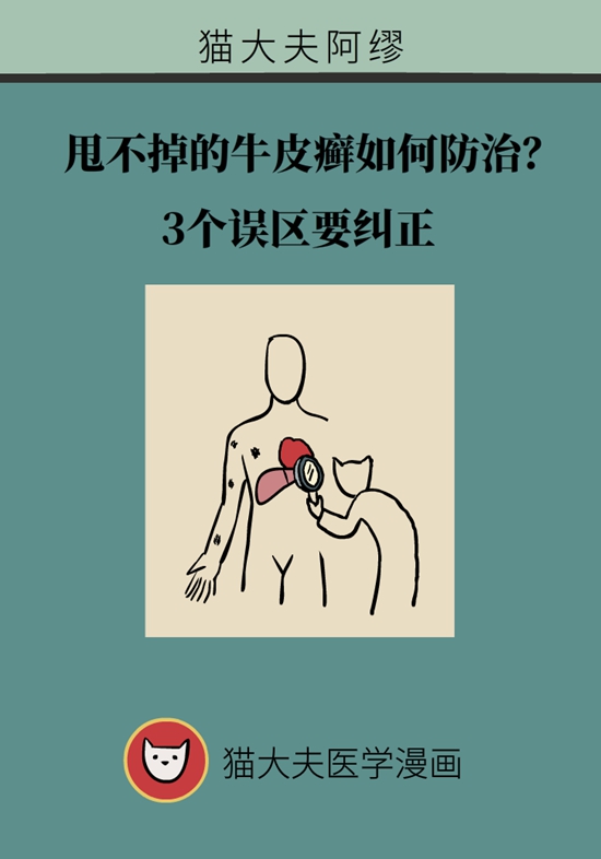 甩不掉的牛皮癬如何防治？3個(gè)誤區(qū)要糾正