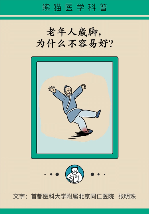 動(dòng)不動(dòng)崴腳與這疾病相關(guān)！解決方法遵循POLICE原則